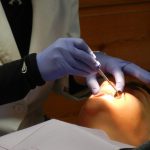 zastosowanie implantu zębowego